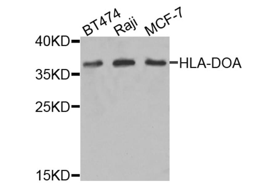 Western Blot - Anti-HLA-DOA Antibody (A6923) - Antibodies.com