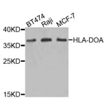 Western Blot - Anti-HLA-DOA Antibody (A6923) - Antibodies.com