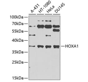 Western Blot - Anti-HOXA1 Antibody (A10029) - Antibodies.com