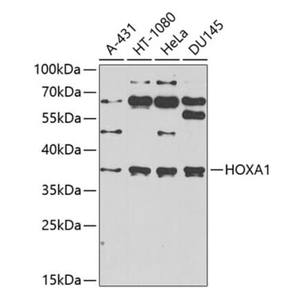 Western Blot - Anti-HOXA1 Antibody (A10029) - Antibodies.com