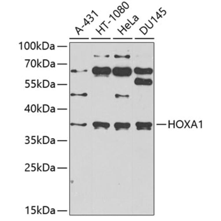 Western Blot - Anti-HOXA1 Antibody (A10029) - Antibodies.com