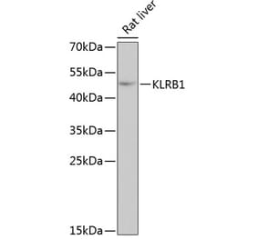 Western Blot - Anti-CD161 Antibody (A10030) - Antibodies.com