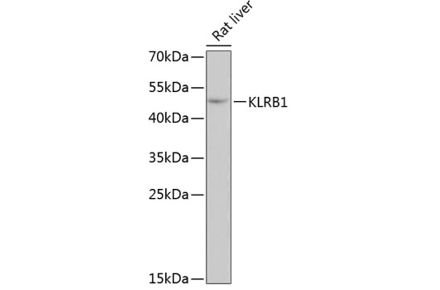Western Blot - Anti-CD161 Antibody (A10030) - Antibodies.com