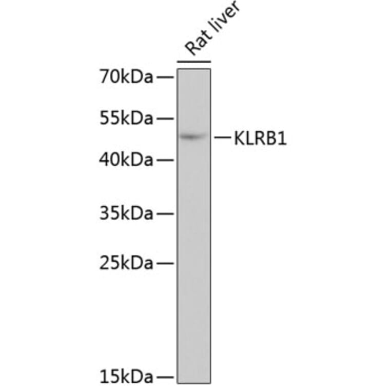 Western Blot - Anti-CD161 Antibody (A10030) - Antibodies.com