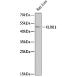 Western Blot - Anti-CD161 Antibody (A10030) - Antibodies.com