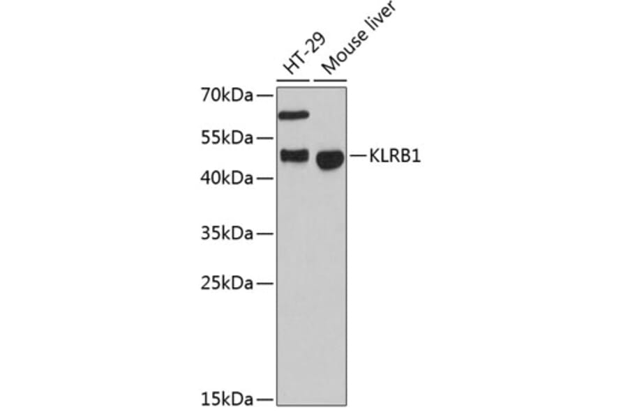 Western Blot - Anti-CD161 Antibody (A10030) - Antibodies.com