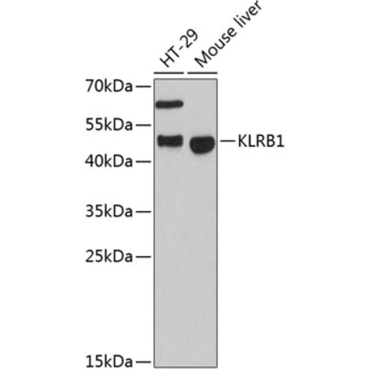 Western Blot - Anti-CD161 Antibody (A10030) - Antibodies.com