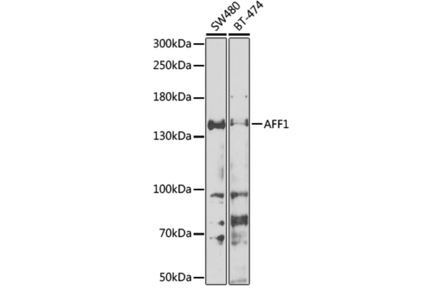 Western Blot - Anti-AF4 Antibody (A10032) - Antibodies.com