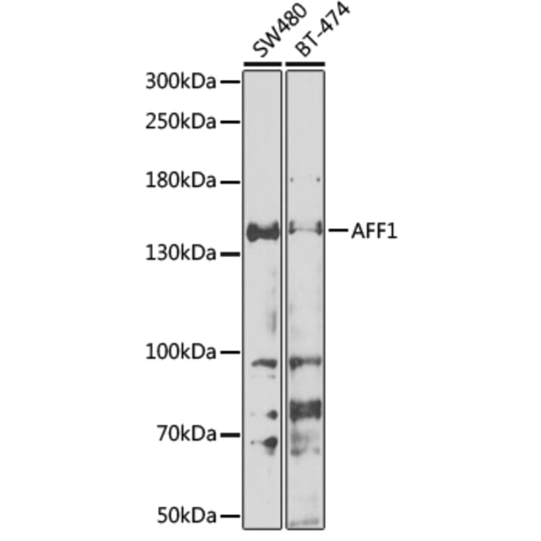 Western Blot - Anti-AF4 Antibody (A10032) - Antibodies.com