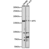 Western Blot - Anti-AF4 Antibody (A10032) - Antibodies.com