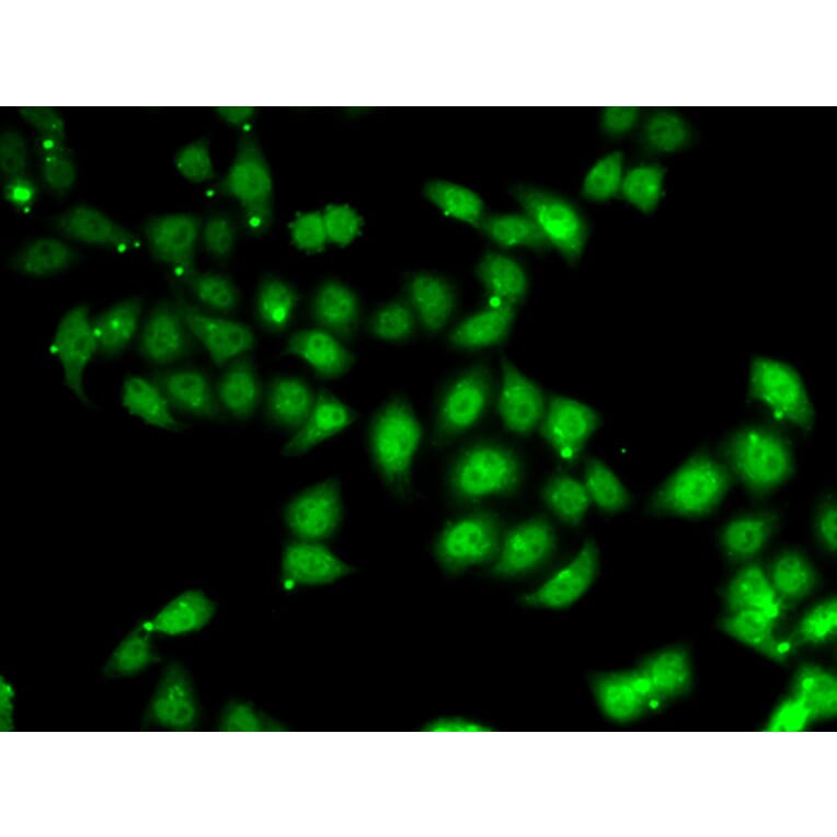 Immunofluorescence - Anti-AF4 Antibody (A10032) - Antibodies.com