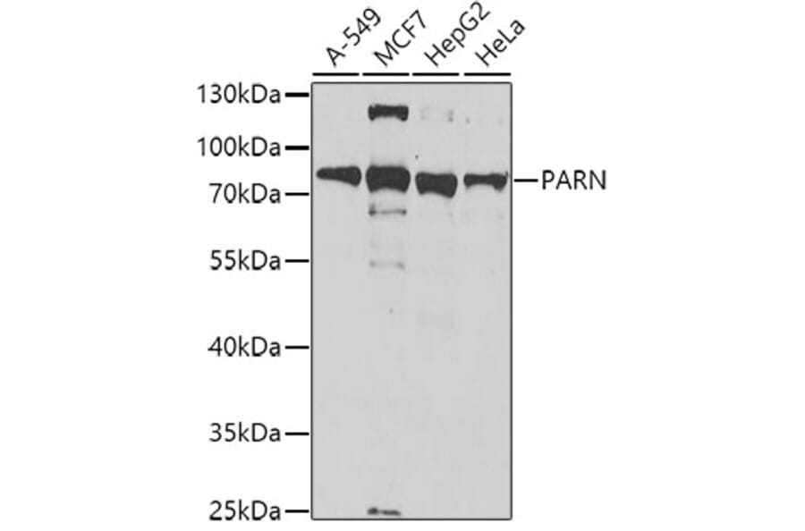 Western Blot - Anti-PARN Antibody (A10034) - Antibodies.com