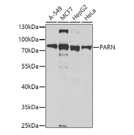 Western Blot - Anti-PARN Antibody (A10034) - Antibodies.com