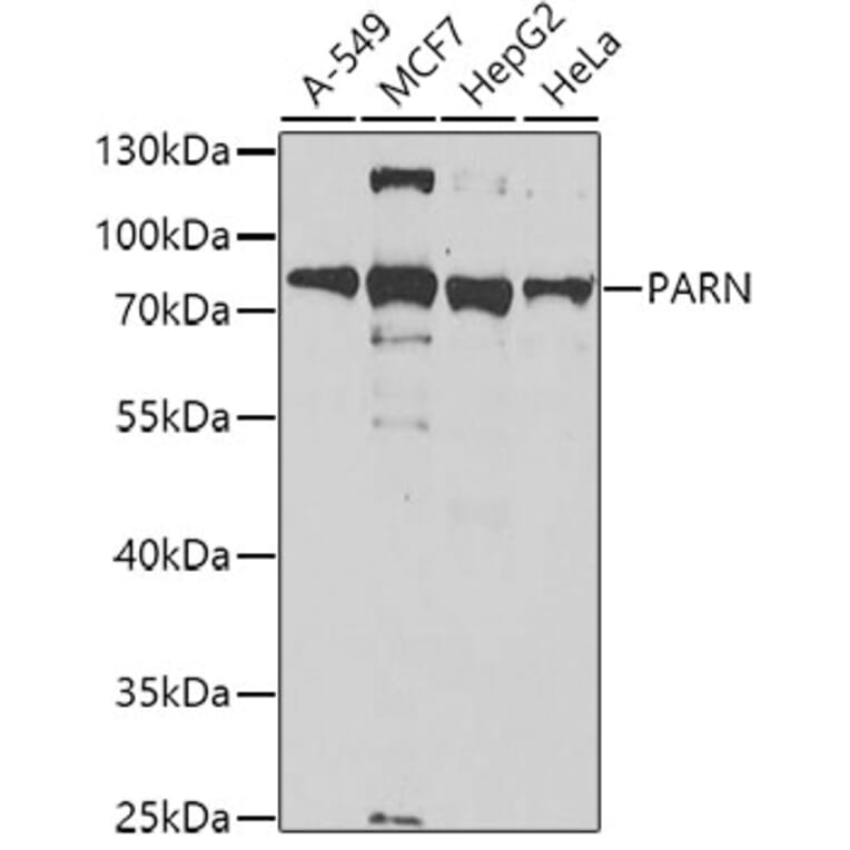 Western Blot - Anti-PARN Antibody (A10034) - Antibodies.com