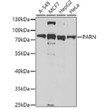 Western Blot - Anti-PARN Antibody (A10034) - Antibodies.com