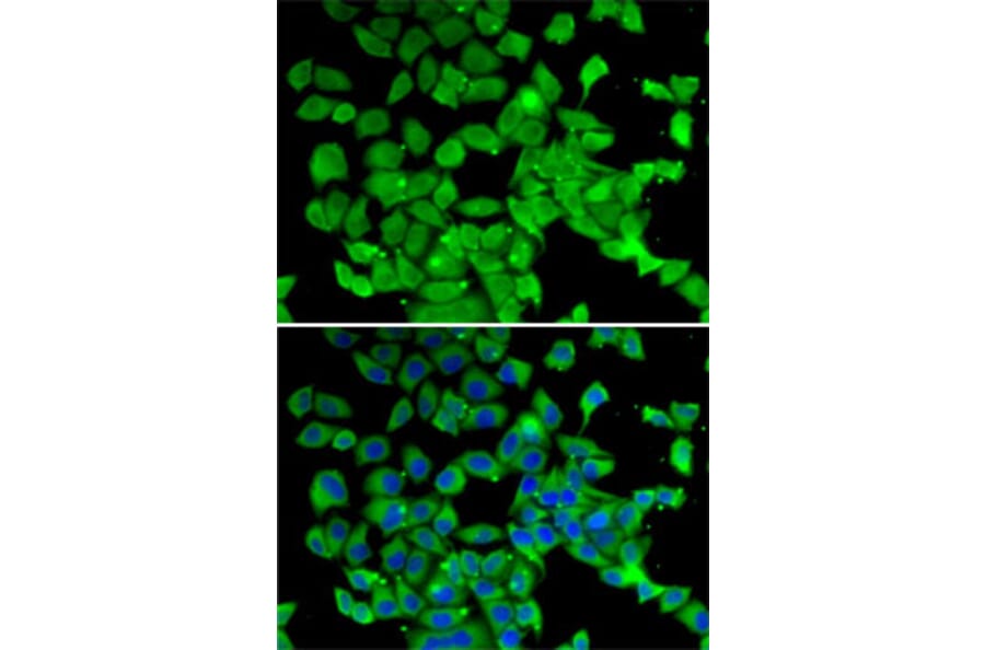 Immunofluorescence - Anti-PARN Antibody (A10034) - Antibodies.com