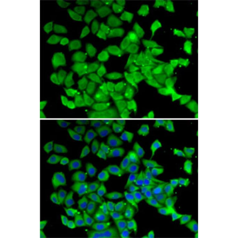 Immunofluorescence - Anti-PARN Antibody (A10034) - Antibodies.com