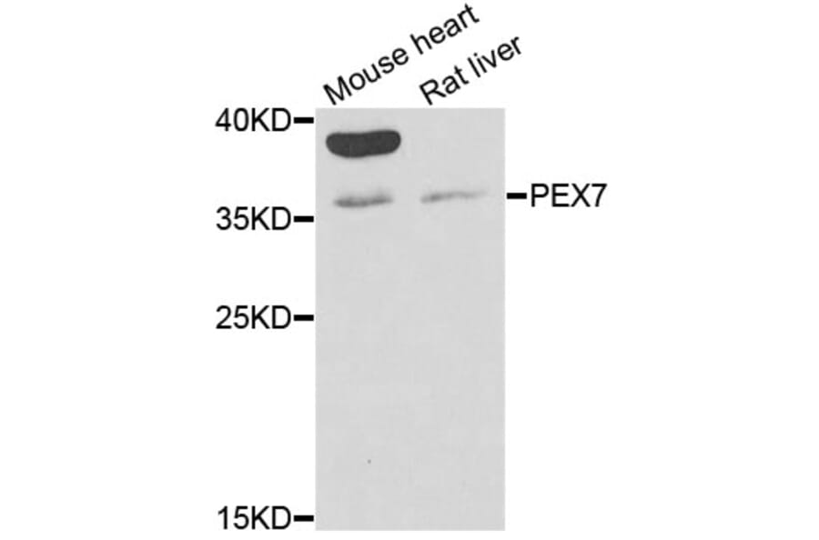 Western Blot - Anti-PEX7 Antibody (A6944) - Antibodies.com