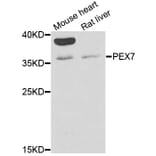 Western Blot - Anti-PEX7 Antibody (A6944) - Antibodies.com