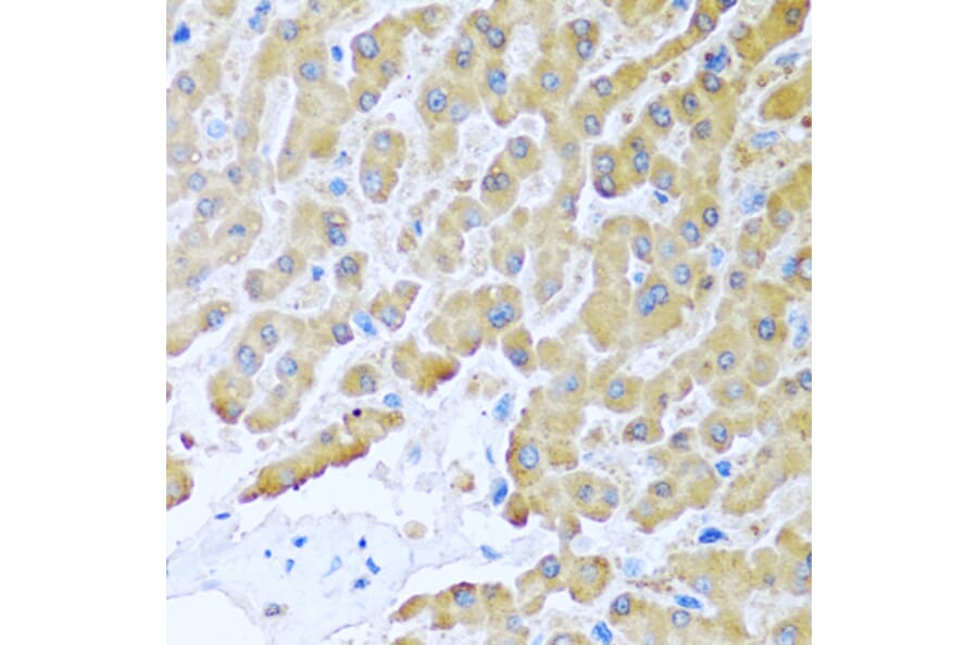 Immunohistochemistry - Anti-MCP2 Antibody (A10037) - Antibodies.com