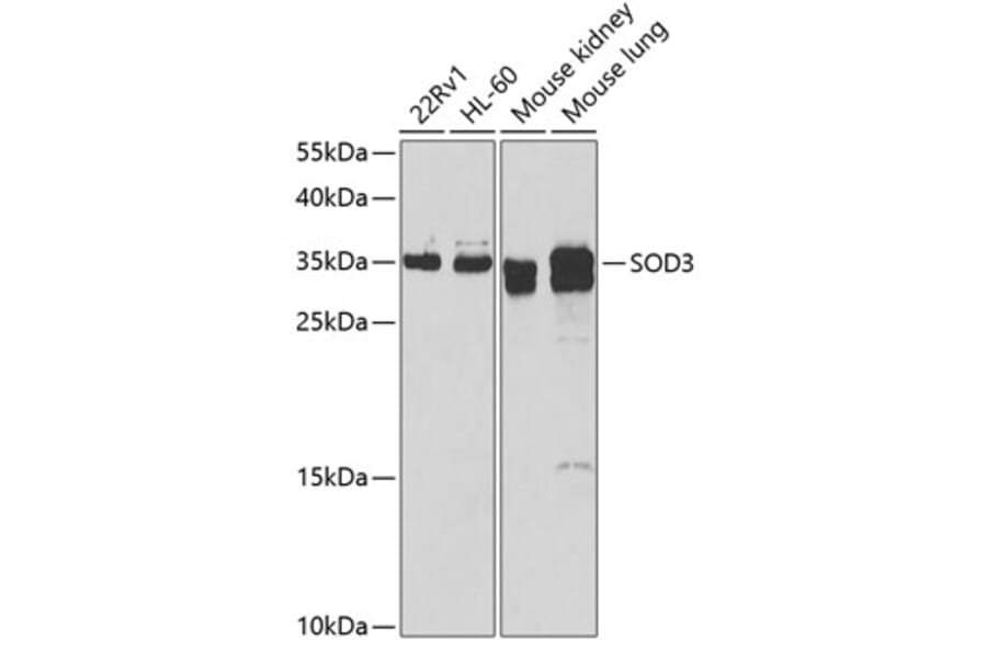 Western Blot - Anti-Superoxide Dismutase 3/EC-SOD Antibody (A10038) - Antibodies.com