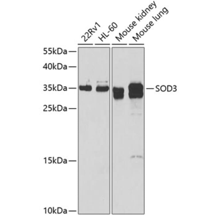 Western Blot - Anti-Superoxide Dismutase 3/EC-SOD Antibody (A10038) - Antibodies.com