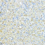Immunohistochemistry - Anti-Superoxide Dismutase 3/EC-SOD Antibody (A10038) - Antibodies.com