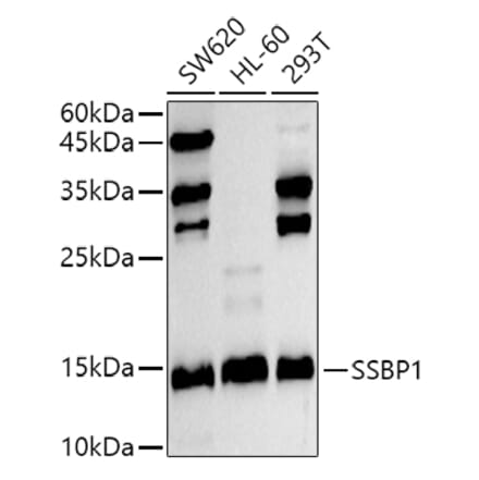 Western Blot - Anti-SSBP1 Antibody (A10039) - Antibodies.com