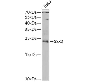 Western Blot - Anti-SSX2 Antibody (A10040) - Antibodies.com