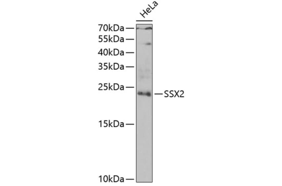 Western Blot - Anti-SSX2 Antibody (A10040) - Antibodies.com