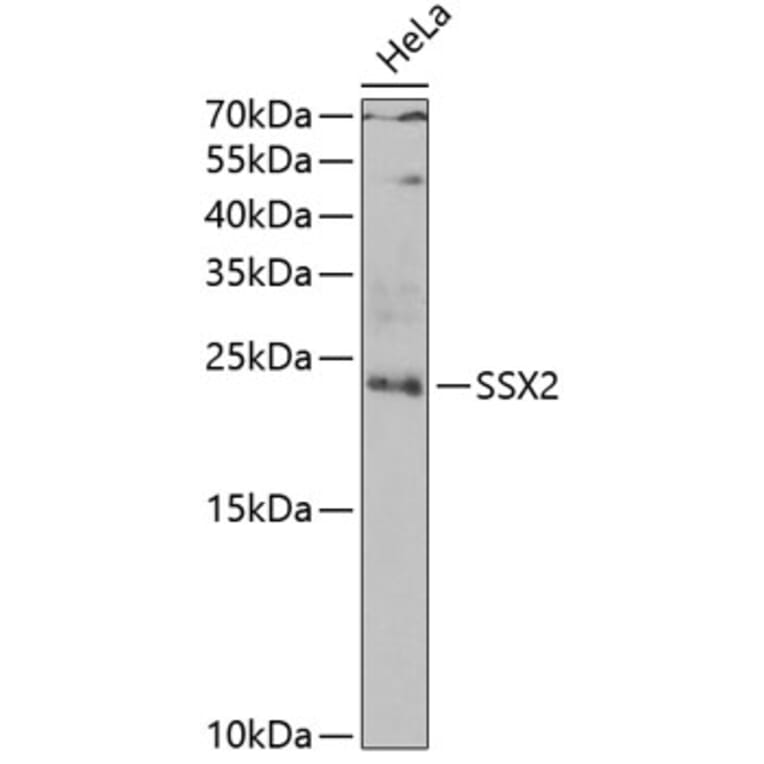 Western Blot - Anti-SSX2 Antibody (A10040) - Antibodies.com