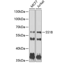 Western Blot - Anti-SS18 Antibody (A10041) - Antibodies.com