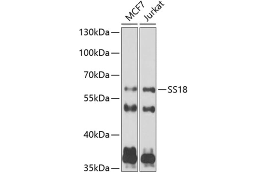 Western Blot - Anti-SS18 Antibody (A10041) - Antibodies.com