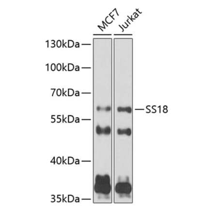 Western Blot - Anti-SS18 Antibody (A10041) - Antibodies.com