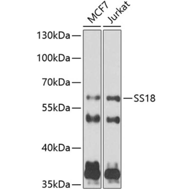 Western Blot - Anti-SS18 Antibody (A10041) - Antibodies.com