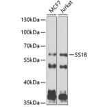 Western Blot - Anti-SS18 Antibody (A10041) - Antibodies.com