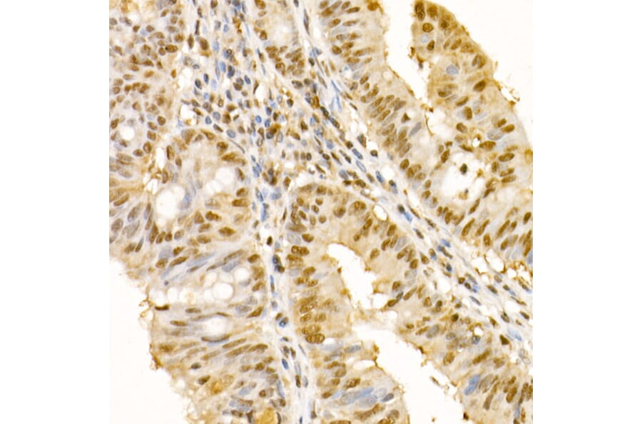 Immunohistochemistry - Anti-SS18 Antibody (A10041) - Antibodies.com