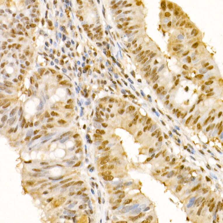 Immunohistochemistry - Anti-SS18 Antibody (A10041) - Antibodies.com