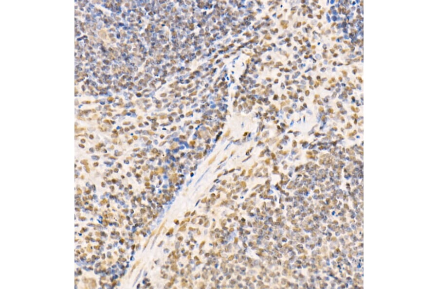 Immunohistochemistry - Anti-SS18 Antibody (A10041) - Antibodies.com