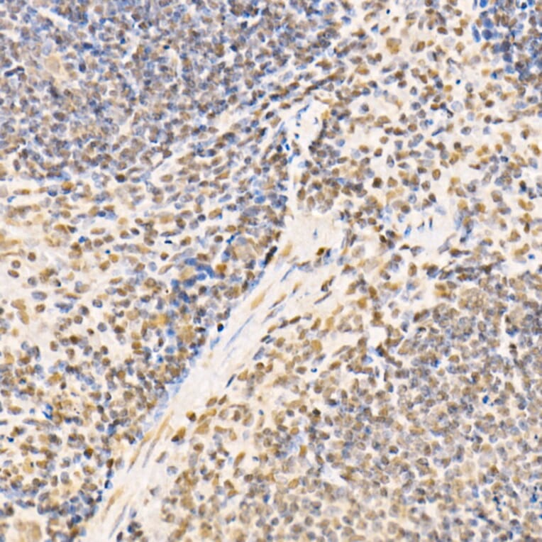 Immunohistochemistry - Anti-SS18 Antibody (A10041) - Antibodies.com