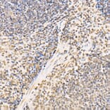 Immunohistochemistry - Anti-SS18 Antibody (A10041) - Antibodies.com