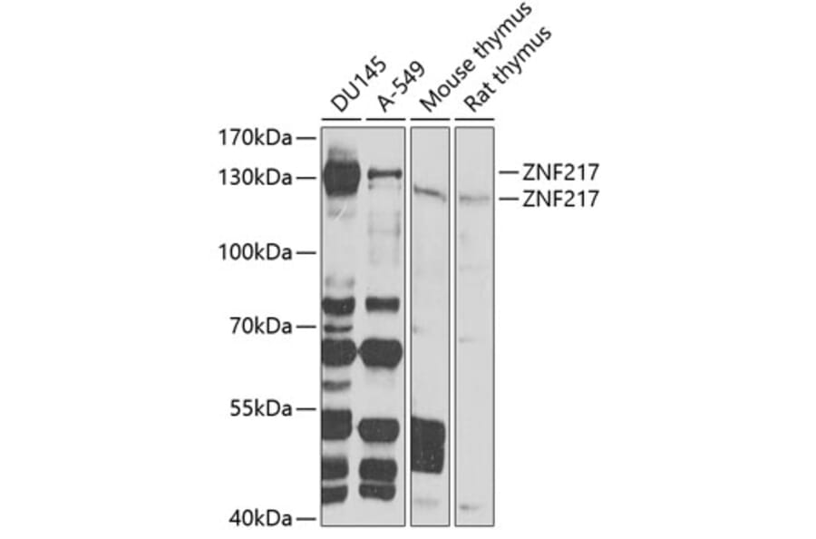 Western Blot - Anti-ZNF217 Antibody (A7002) - Antibodies.com