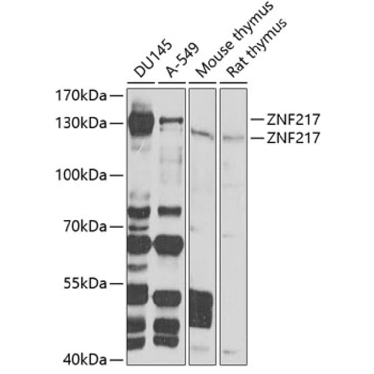 Western Blot - Anti-ZNF217 Antibody (A7002) - Antibodies.com