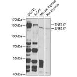 Western Blot - Anti-ZNF217 Antibody (A7002) - Antibodies.com