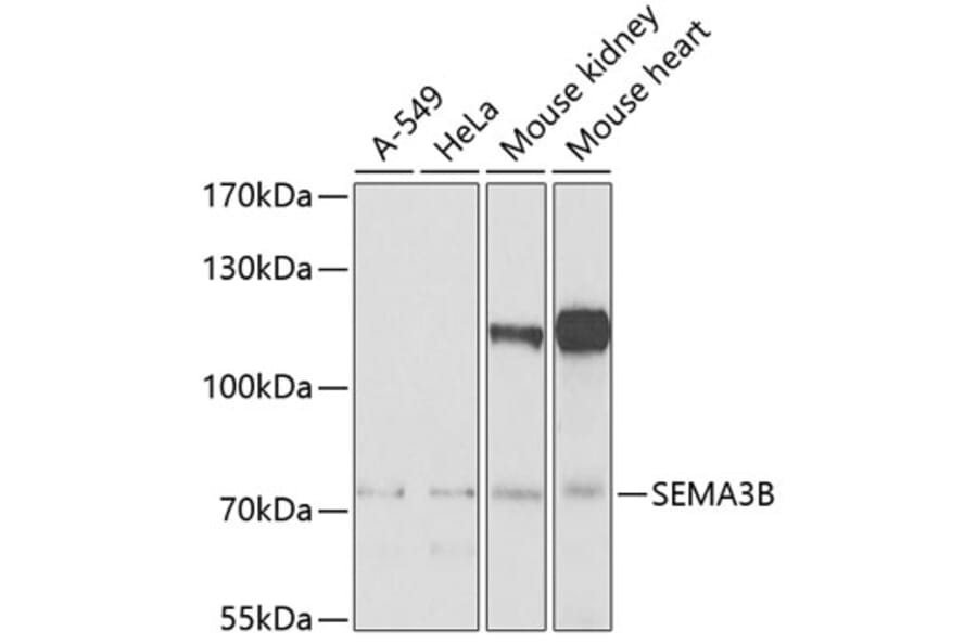 Western Blot - Anti-SEMA3B Antibody (A10043) - Antibodies.com