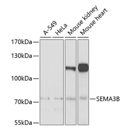 Western Blot - Anti-SEMA3B Antibody (A10043) - Antibodies.com