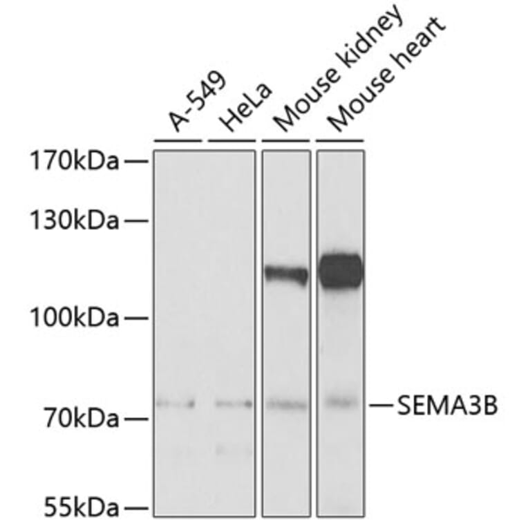 Western Blot - Anti-SEMA3B Antibody (A10043) - Antibodies.com