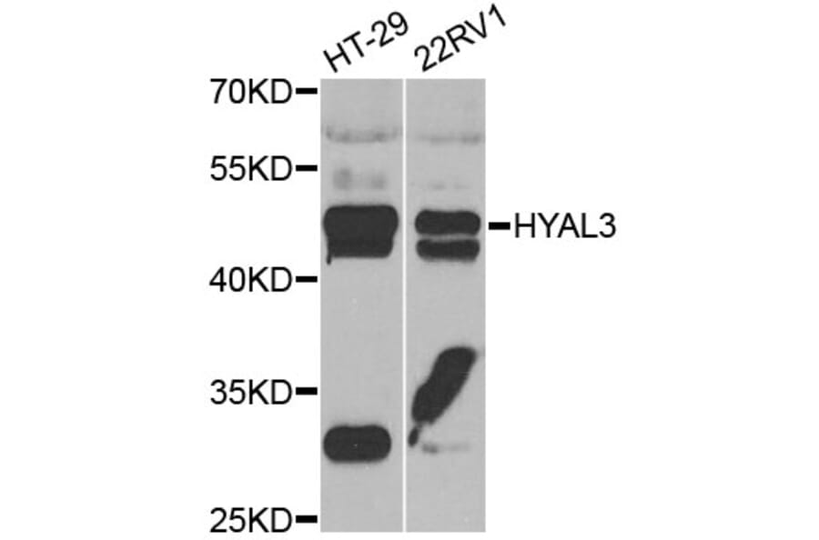 Western Blot - Anti-HYAL3 Antibody (A7011) - Antibodies.com