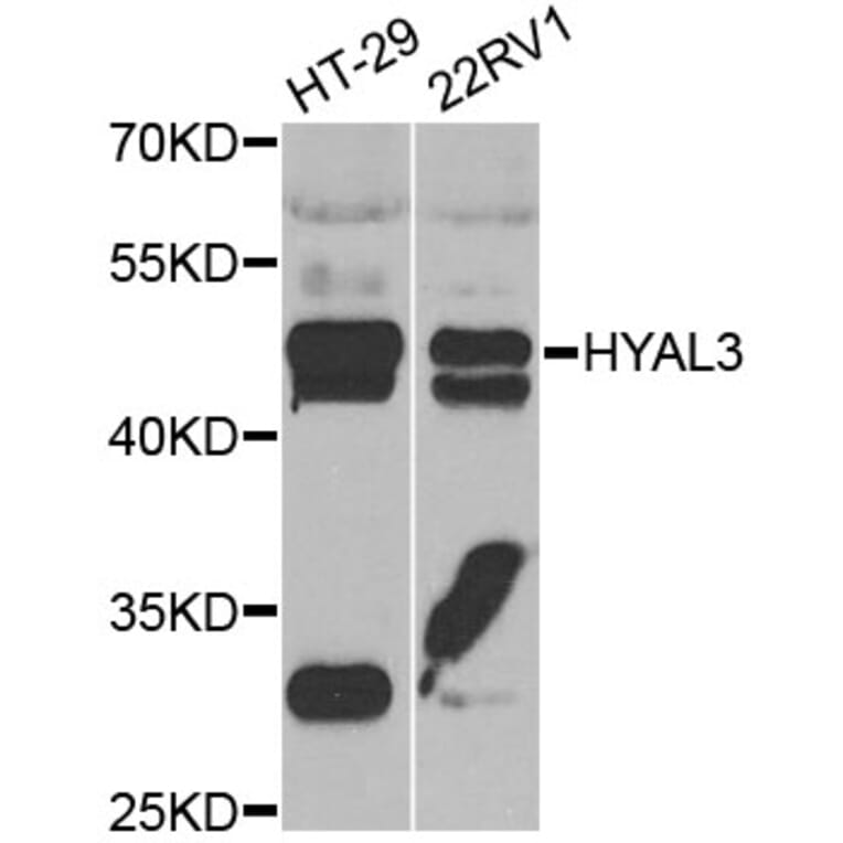 Western Blot - Anti-HYAL3 Antibody (A7011) - Antibodies.com