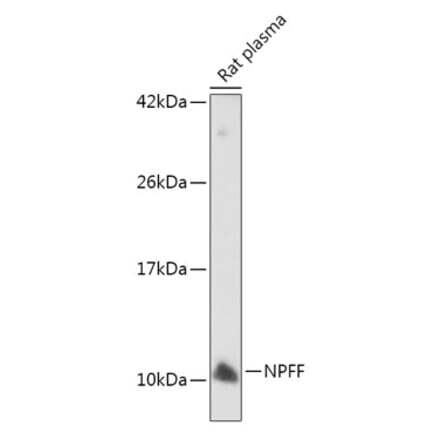 Western Blot - Anti-NPFF Antibody (A7020) - Antibodies.com